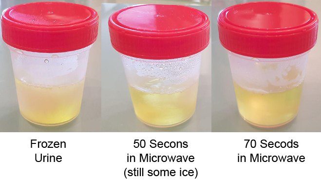 l'urine au micro-ondes