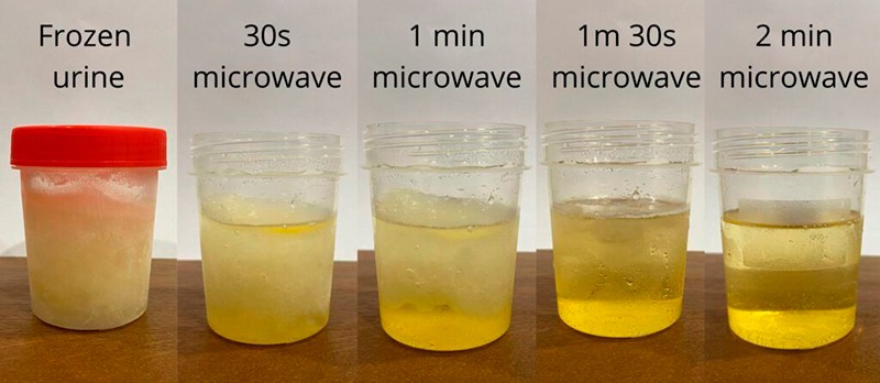 frozen urine thawing in microwave progress