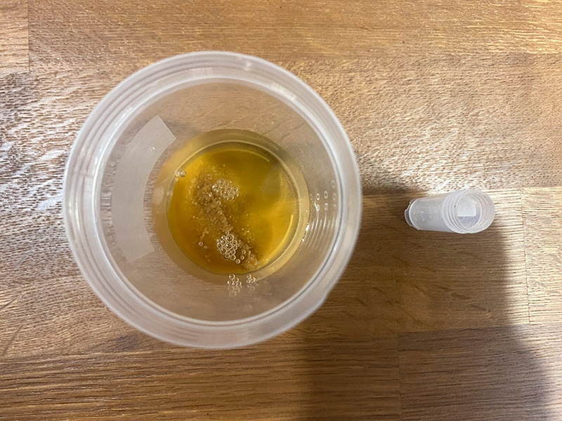 sub solution urine powder dropped into the cup as one piece