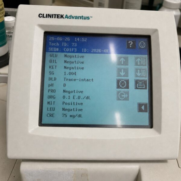 monkey whizz clinitek analyzer